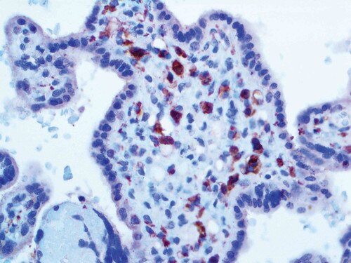 IHC of Factor XIIIa on an FFPE Placenta Tissue